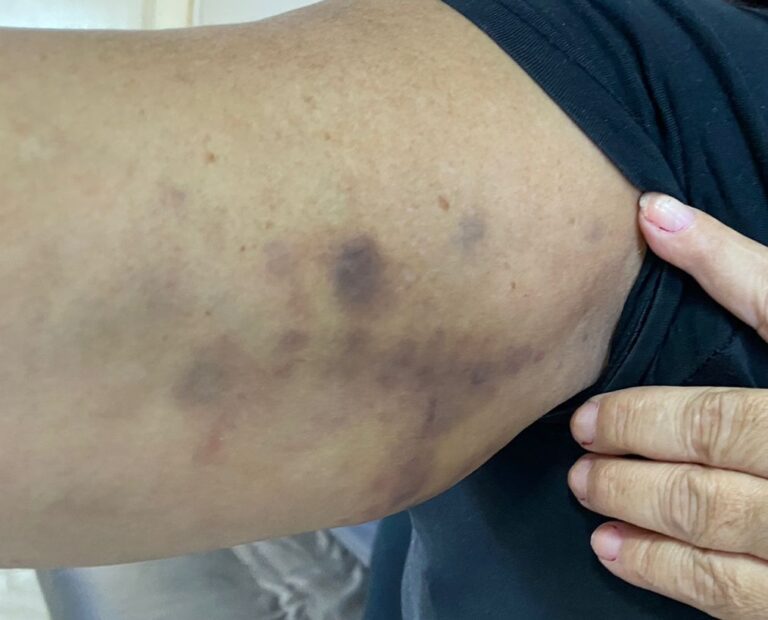 Mulher é resgatada em cárcere privado após ser agredida pelo marido